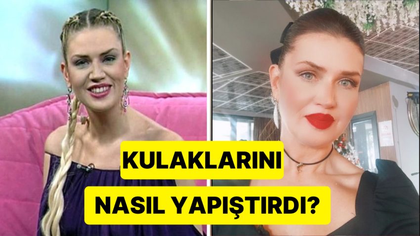 Eski Model Tabiat Bekleriz’in Kepçe Kulaklarını Yapıştırma Olayının Enteresan Ayrıntıları
