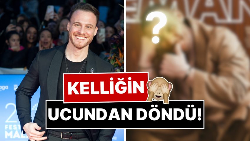 Kelliğin Ucundan Döndü: Saç Ektirdiği Ortaya Çıkan Kerem Bürsin’den Yeni İmajıyla Yeni Pozlar!