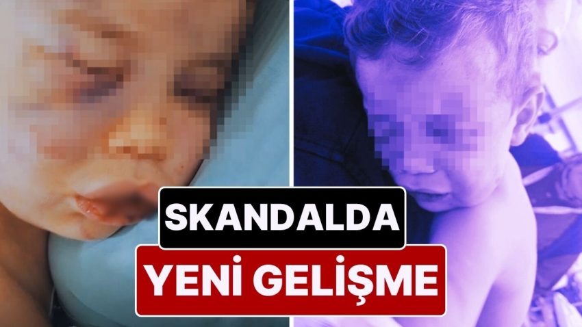 2 Yaşındaki Aren Bebeği Hastanelik Eden Caniler Gözaltında: Aren’i Yakmaya Çalışmışlar!