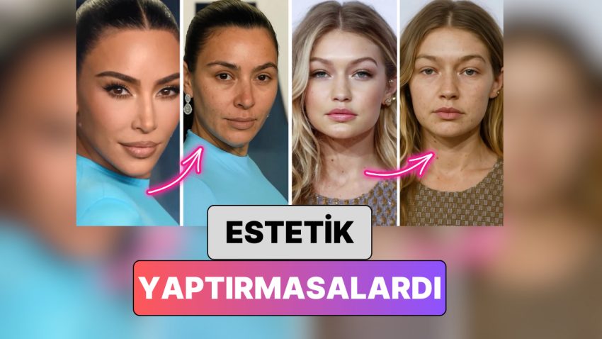 Bir Doktor Yapay Zeka ile Ünlü İsimlerin Estetiklere Başvurmasalardı Nasıl Görüneceklerini Gösterdi