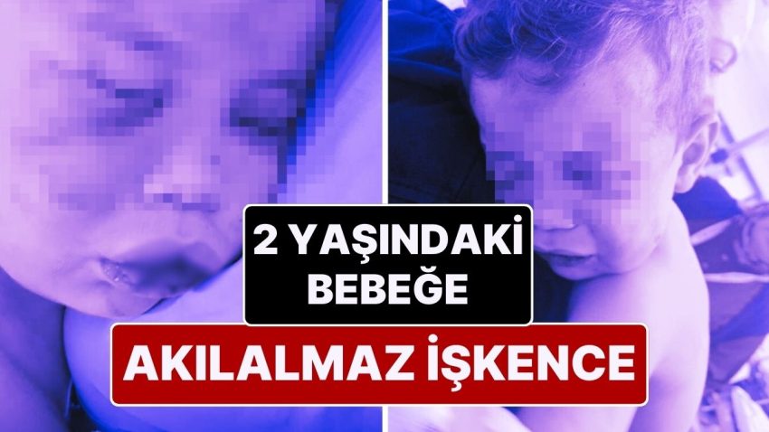 Denizli’de Kan Donduran Olay! 2 Yaşındaki Bebek Dövülerek Hastanelik Edildi