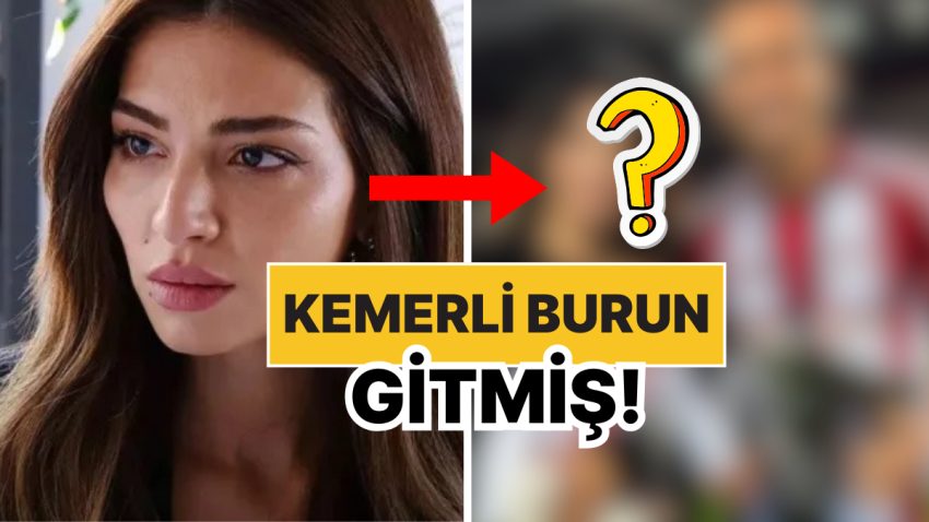 Kemerli Burun Gitmiş: Melisa Aslı Pamuk’nun Doğum Sonrası Yüzündeki Değişim Olay Oldu!