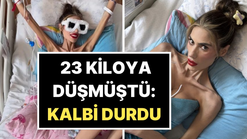 23 Kiloya Düşen Nihal Candan’ın Kalbi Durdu: Hayata Döndürülmeye Çalışılıyor!