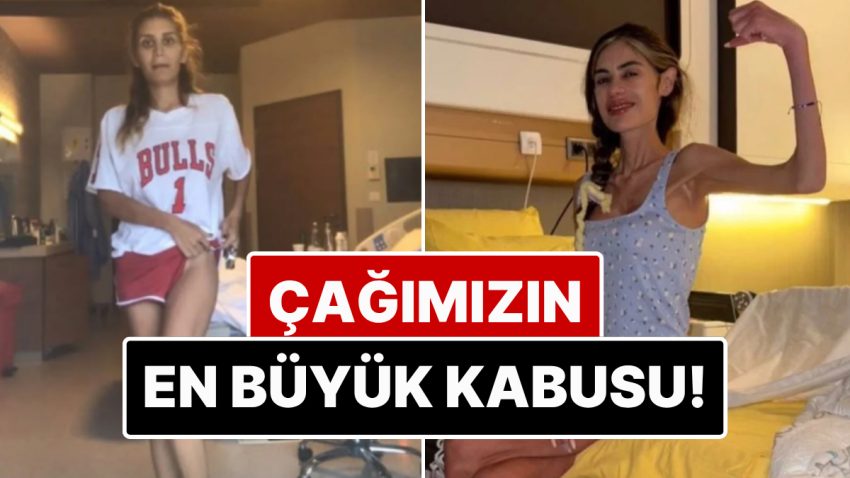 Çağımızın En Büyük Sıhhat Meselelerinden Biri: Anoreksiya Nervoza Hastalığı ile Savaşan Ünlü İsimler