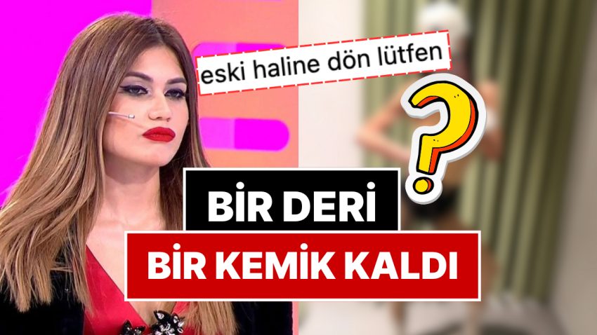 Cezaevinden Anoreksiya Hastalığı Nedeniyle Tahliye Edilen Nihal Candan’ın Son Hali Korkuttu