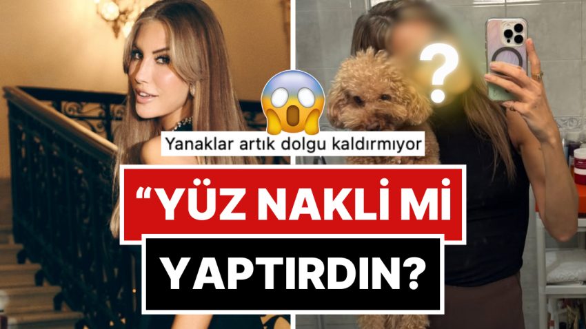 Göksel’le Tıpkı Doktora mı Gidiyorlar? Çağla Şikel’in Dozu Kaçmış Dolgularıyla Verdiği Poz “Bu Kim” Dedirtti!