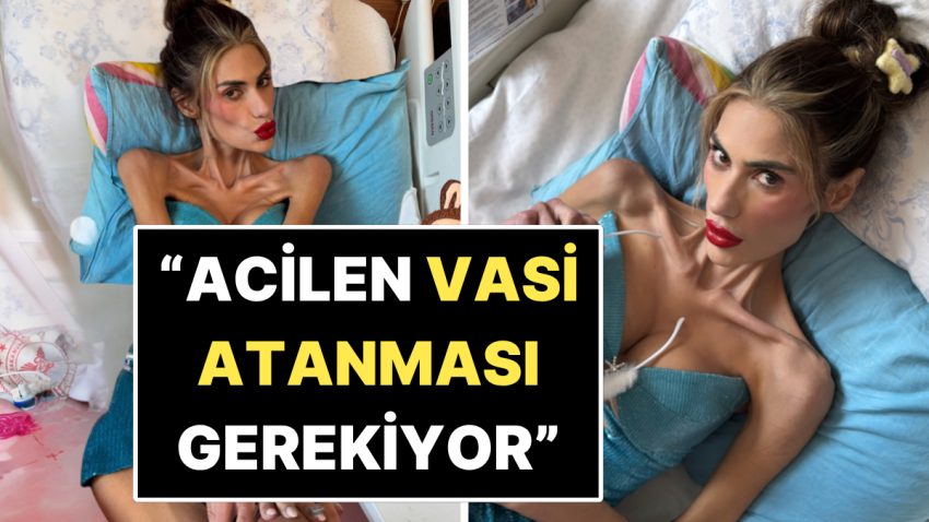 İvedilikle Vasi Atanması Gerekiyor: 29 Kiloya Düşen Nihal Candan’ın Durumunun Berbata Gittiği Öğrenildi