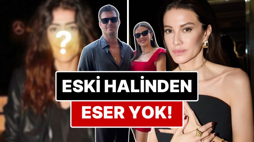Kıvanç Tatlıtuğ’un Eşi Başak Dizer’in Yıllar İçerisinde Giderek Gençleşmesi Kullanıcıları İkiye Böldü!