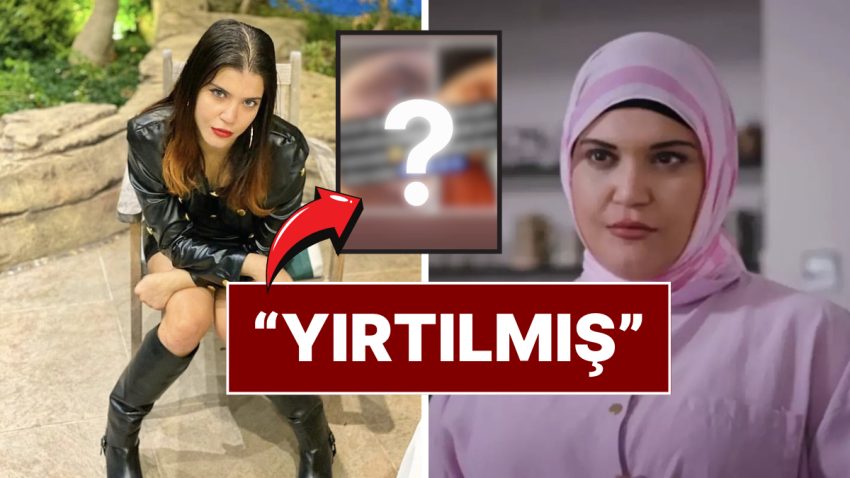 Kızılcık Şerbeti’nin Nilay’ı Feyza Civelek Hastanelik Oldu: Paylaşımıyla Gözünün Son Halini Paylaştı!