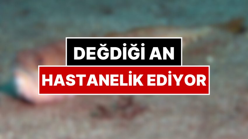 Kollarda Çürüme, Dokuda Vefat: Bu Balığı Görenler Dikkat! Değdiği An Hastanelik Ediyor