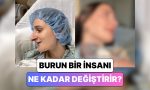 bir-bayan-gecirdigi-burun-estetigi-operasyonundan-sonra-yasadigi-degisimi-paylasti-XXVIv7Ri.jpg