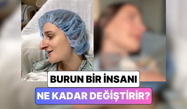 bir-bayan-gecirdigi-burun-estetigi-operasyonundan-sonra-yasadigi-degisimi-paylasti-XXVIv7Ri.jpg