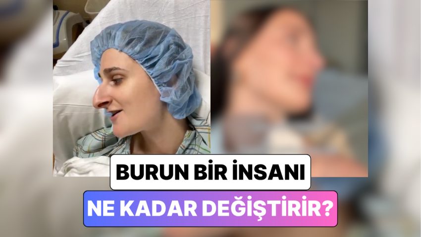 Bir Bayan Geçirdiği Burun Estetiği Operasyonundan Sonra Yaşadığı Değişimi Paylaştı
