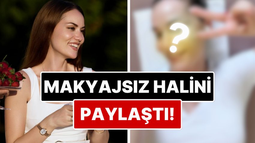 Doğal Yüzü Dikkat Çekti: Estetik Savlarını Yalanlayan Fahriye Evcen Makyajsız Halini Paylaştı!