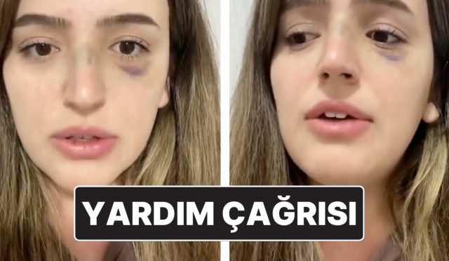 esinden-siddet-goren-bayanin-yardim-daveti-lutfen-sesim-olun-iEhFl8Cx.jpg