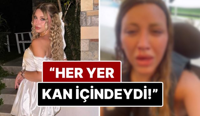 gozyaslari-icinde-paylasti-toplumsal-medya-fenomeni-mika-raun-tatil-icin-gittigi-dubaide-otomobil-kazasi-uAA16siD.jpg