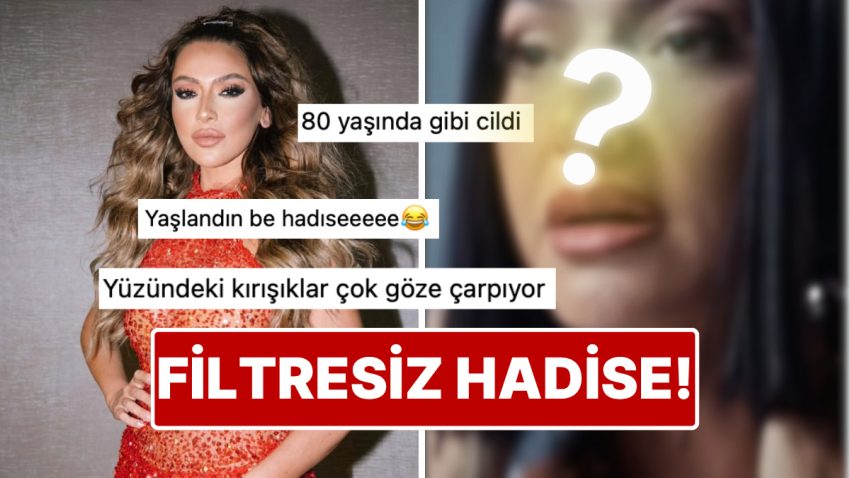 Ne Photoshop Ne Filtre Var: Hadise’nin Klibinden Paylaştığı Kesitte Yüzündeki Kırışıklıklar Dikkat Çekti!
