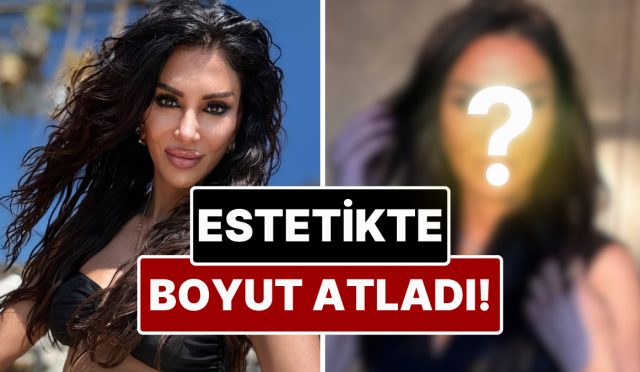yok-bu-turlu-estetik-hosluk-merkezleri-sahibi-emsal-dogan-gecirdigi-operasyonla-gozlerinin-rengini-degistirdi-td24BwEB.jpg
