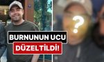 11-sefer-ameliyat-geciren-murat-dalkilicin-burnunun-ucu-estetik-mudahalelerle-duzeltildi-wvr7ikYQ.jpg