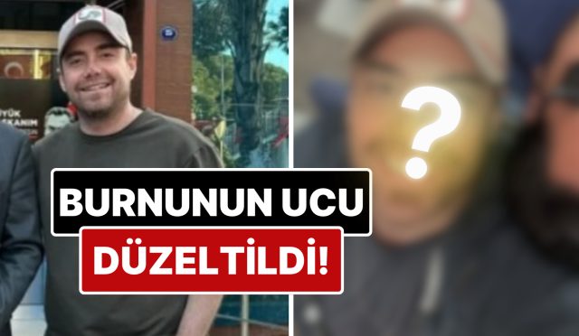 11-sefer-ameliyat-geciren-murat-dalkilicin-burnunun-ucu-estetik-mudahalelerle-duzeltildi-wvr7ikYQ.jpg