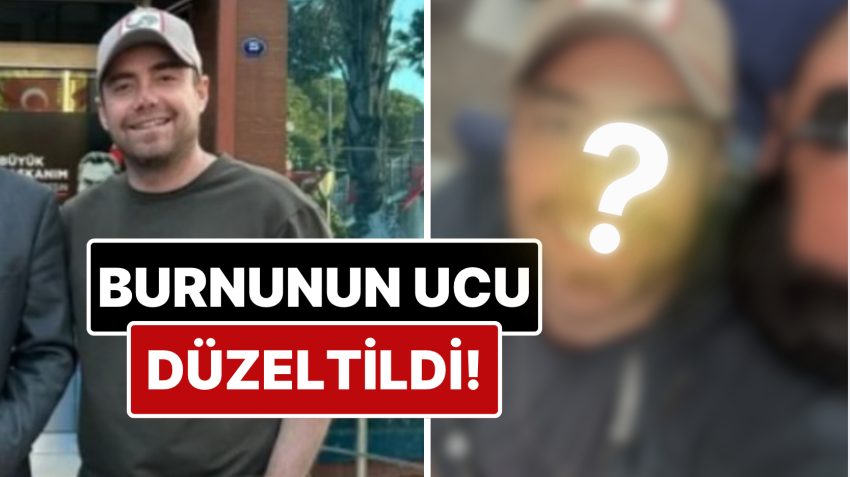 11 Sefer Ameliyat Geçiren Murat Dalkılıç’ın Burnunun Ucu Estetik Müdahalelerle Düzeltildi!
