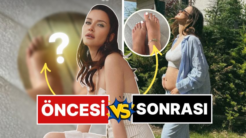 7 Aylık Gebe İrem Helvacıoğlu Hamilelikte Ödemden Kocaman Olan Ayaklarının Dermanını Bakın Ne ile Buldu?