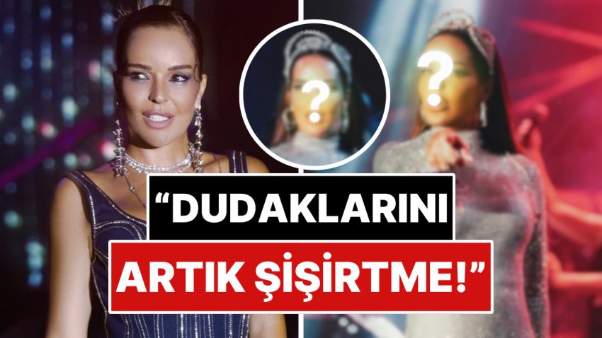 “Bari Sen Yapma N’olur”: Ünlü Müzikçi Bengü Son Pozlarında Şiştikçe Şişen Dudağıyla Dikkat Çekti!