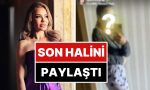 beyninde-kitle-tespit-edildigini-aciklayan-muzikci-lara-son-halini-paylasti-mqPlpKrZ.jpg