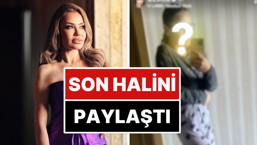 Beyninde Kitle Tespit Edildiğini Açıklayan Müzikçi Lara, Son Halini Paylaştı