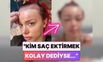 biz-sac-ekimi-ulkesiyiz-sac-ektirme-sureci-yaptiran-bir-bayan-yuzunun-geldigi-hali-paylasti-SLTOJwep.jpg