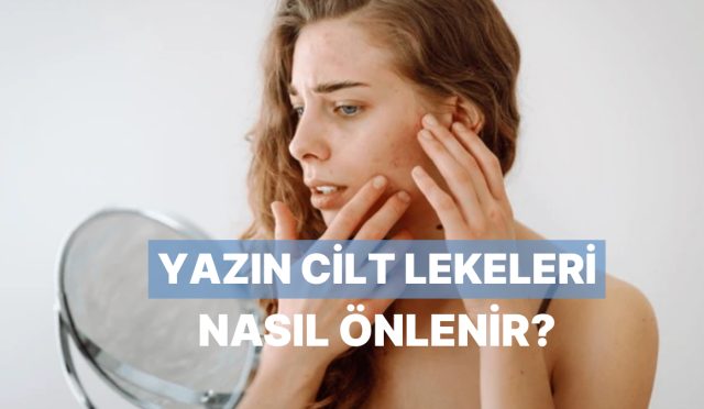 ciltteki-leke-gorunumune-karsi-yaz-aylarinda-alabileceginiz-tedbirler-3OTgHEaZ.jpg