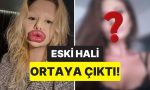 dunyanin-en-buyuk-dudakli-kadini-olarak-biliniyordu-estetik-gecirmeden-evvelki-hali-sasirtti-reSLnDVZ.jpg