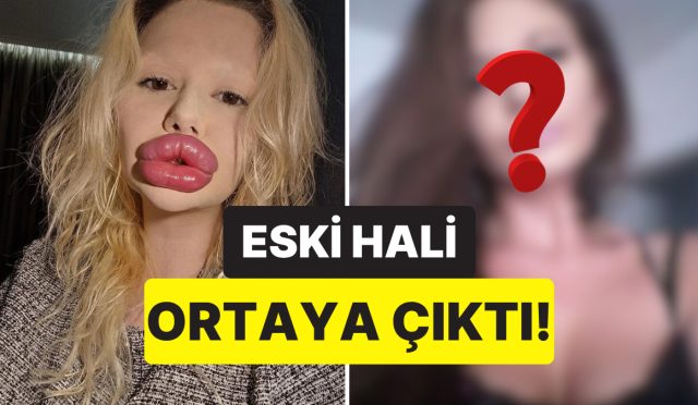 dunyanin-en-buyuk-dudakli-kadini-olarak-biliniyordu-estetik-gecirmeden-evvelki-hali-sasirtti-reSLnDVZ.jpg