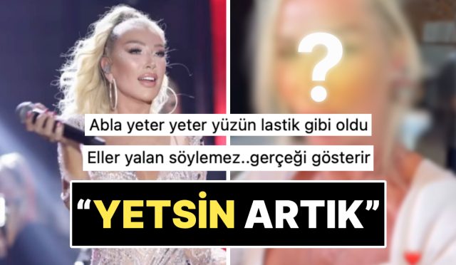 eller-palavra-soylemez-yeni-yaptirdigi-estetikle-yuzunun-kalktigina-inanan-seda-sayan-son-halini-paylasti-tGFs6q9J.jpg