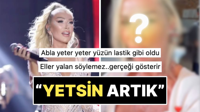 “Eller Palavra Söylemez”: Yeni Yaptırdığı Estetikle Yüzünün Kalktığına İnanan Seda Sayan Son Halini Paylaştı!