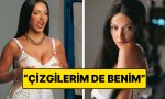 hadise-yuzundeki-kirisikliklara-laf-edenlere-had-bildiren-bir-paylasim-yapti-a1L3WyPR.jpg