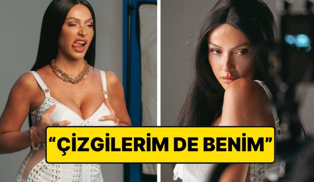 hadise-yuzundeki-kirisikliklara-laf-edenlere-had-bildiren-bir-paylasim-yapti-a1L3WyPR.jpg