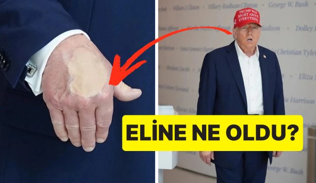 hasta-oldugu-dusunuluyor-abd-baskani-donald-trumpin-elindeki-fondoten-ne-manaya-geliyor-Xrub1Qei.jpg