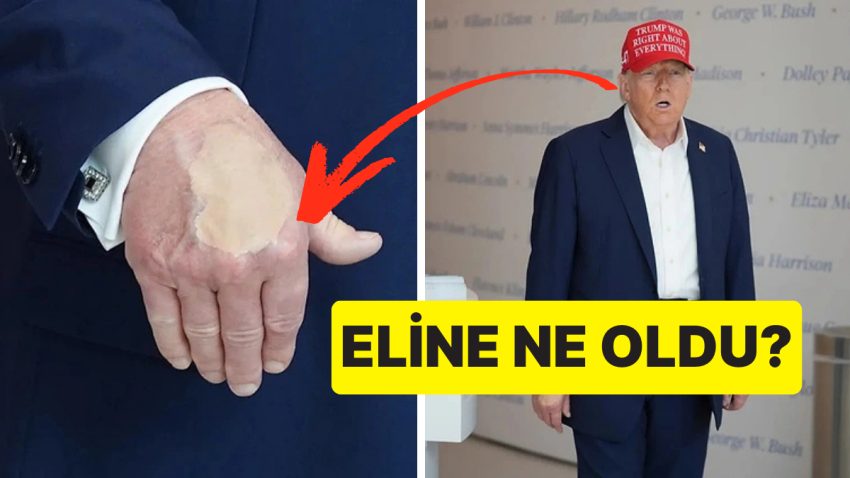 Hasta Olduğu Düşünülüyor: ABD Başkanı Donald Trump’ın Elindeki Fondöten Ne Manaya Geliyor?