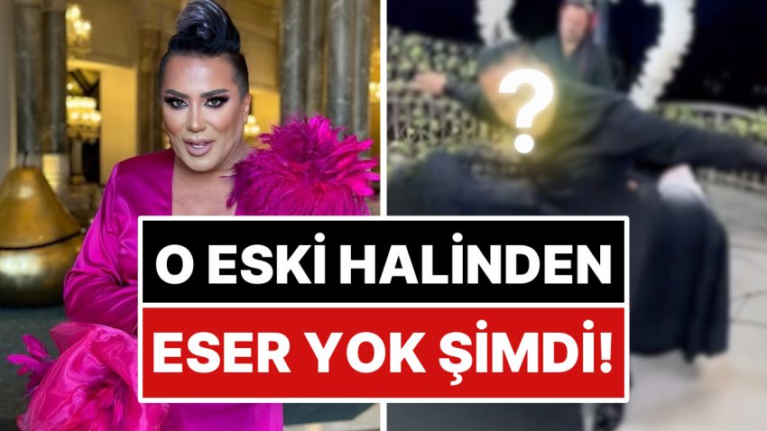Hesabına Erişim Mahzuru Yedikten Sonra Birinci Sahnesine Çıkan Murat Övüç’ten Radikal Şekil Değişikliği!
