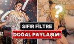 hosluk-algilarina-rest-cekti-bir-devir-yuzundeki-izlerle-cok-konusulan-izelden-filtresiz-paylasim-eGzmfCZB.jpg