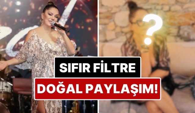 hosluk-algilarina-rest-cekti-bir-devir-yuzundeki-izlerle-cok-konusulan-izelden-filtresiz-paylasim-eGzmfCZB.jpg