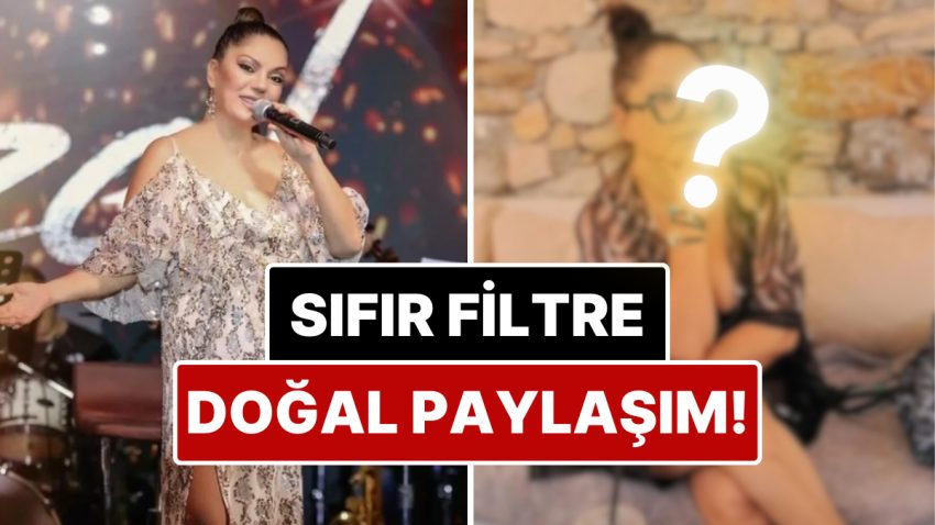 Hoşluk Algılarına Rest Çekti: Bir Devir Yüzündeki İzlerle Çok Konuşulan İzel’den Filtresiz Paylaşım!