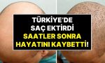 ingiltereden-turkiyeye-sac-ektirmeye-gelen-hasta-ameliyat-sonrasi-hayatini-kaybetti-MSvduJRp.jpg