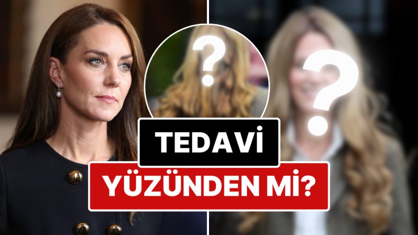 Kanser Teşhisi Konulmasının Akabinde Ortadan Kaybolan Kate Middleton’ın Yeni Saçları Peruk Tezlerini Doğurdu
