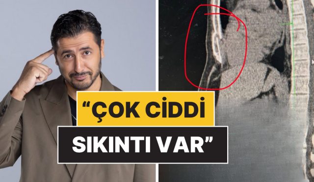 karadagda-gecirdigi-kazada-gogus-kemigi-kirilan-taner-cagli-sihhat-sistemine-reaksiyon-gosterdi-SeL9Tydp.jpg