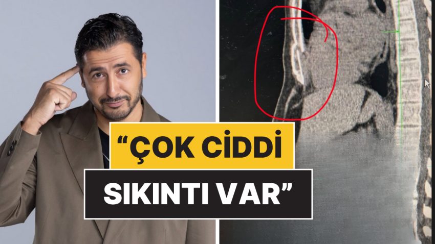 Karadağ’da Geçirdiği Kazada Göğüs Kemiği Kırılan Taner Çağlı Sıhhat Sistemine Reaksiyon Gösterdi