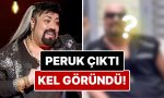 peruk-dustu-kel-gorundu-protez-saci-yuzunden-enfeksiyon-kapan-kobra-muratin-sacsiz-hali-ortaya-DgX81DqV.jpg