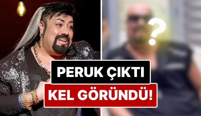 peruk-dustu-kel-gorundu-protez-saci-yuzunden-enfeksiyon-kapan-kobra-muratin-sacsiz-hali-ortaya-DgX81DqV.jpg