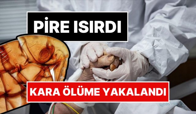 pire-isirmasiyla-hayati-karardi-abdde-bir-kisi-kara-mevte-yakalandi-8PKQ6hzC.jpg